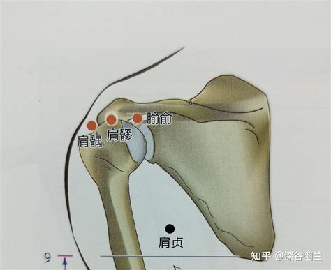 肩ㄩˊ穴|醫砭 » 經穴庫 » 肩髎